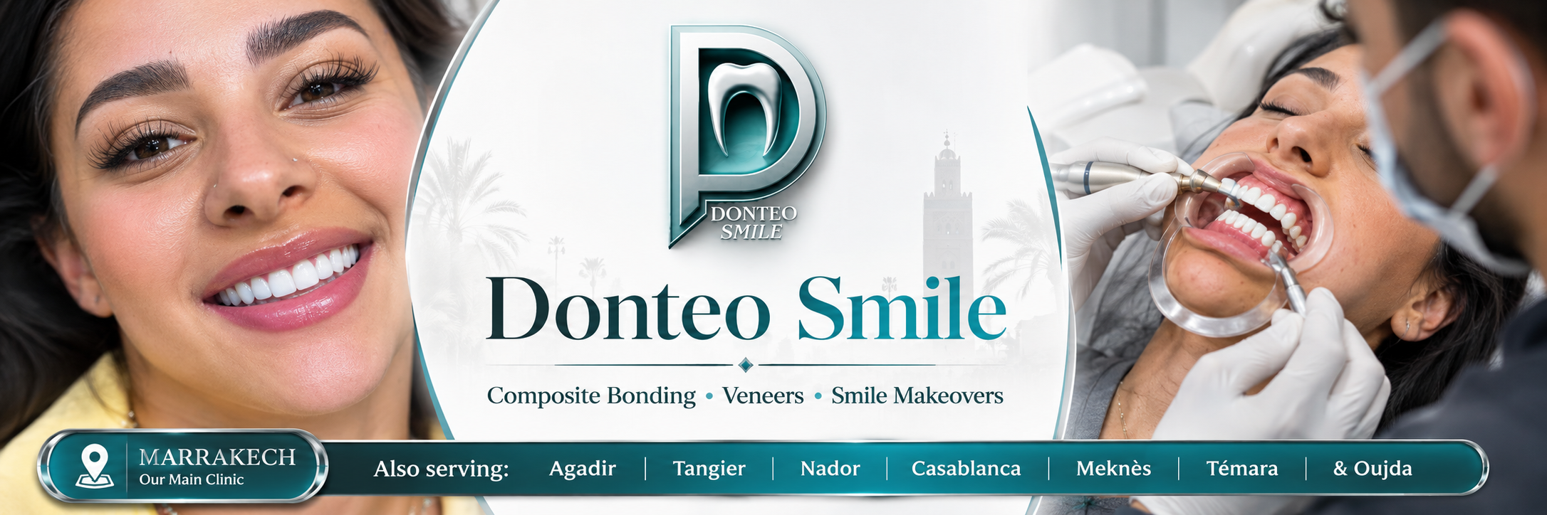 Donteo Smile 1